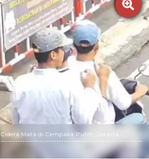 Polisi Tangkap Tiga Pelajar Penyiram Air Keras kepada Pelajar SMK